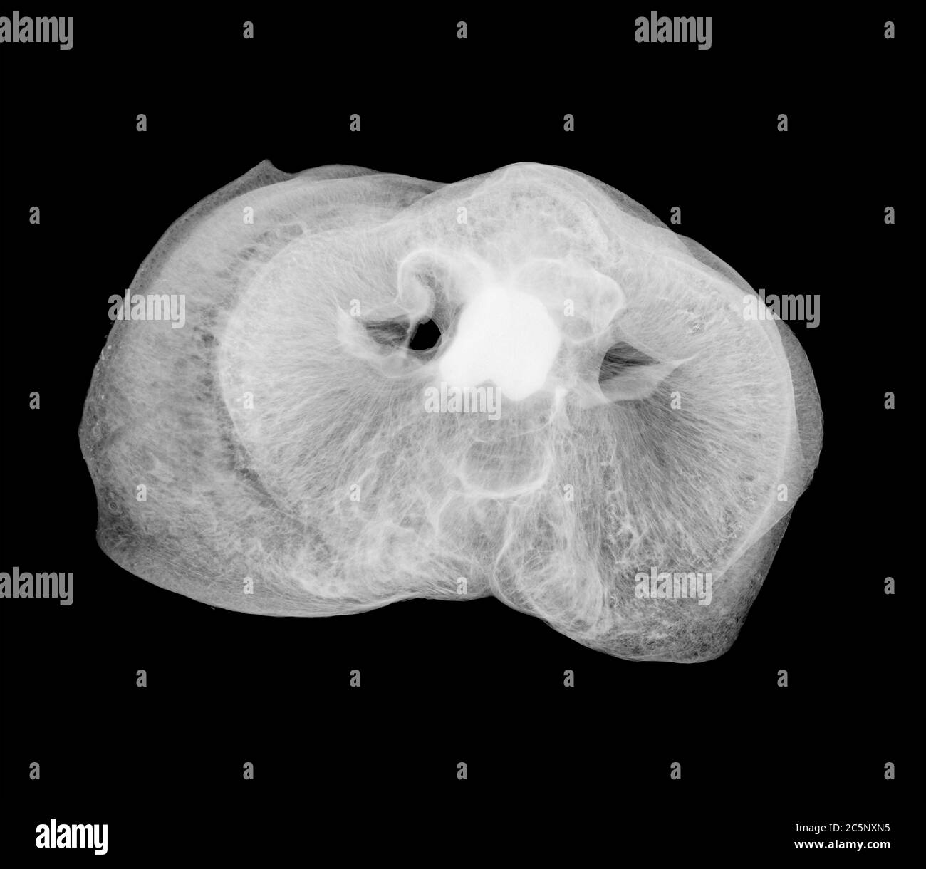 El pico del cerdo, rayos X. Foto de stock