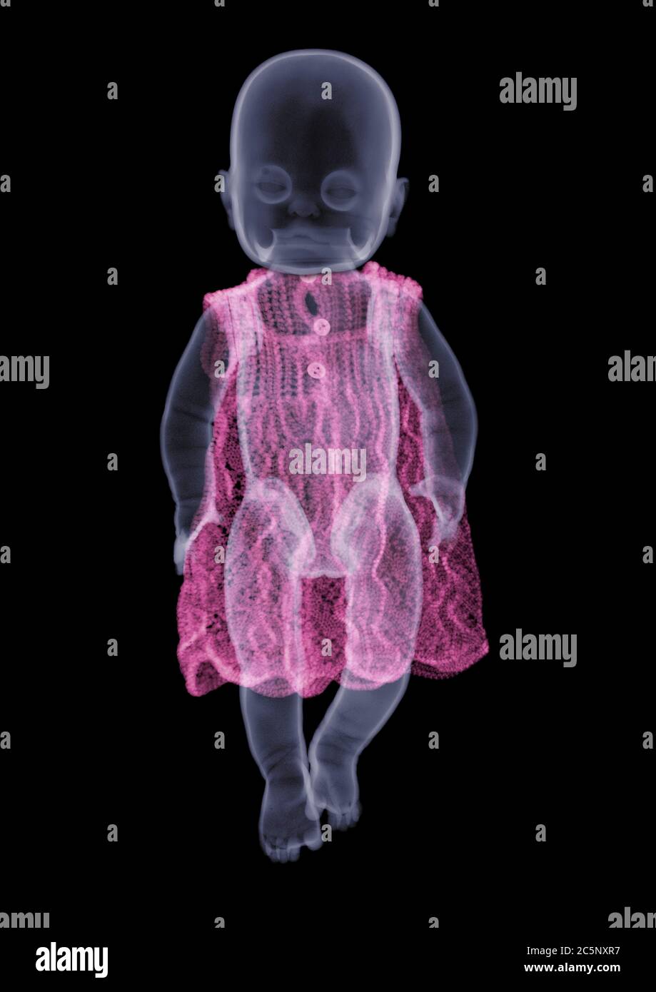 Muñeca con vestido, rayos X. Foto de stock