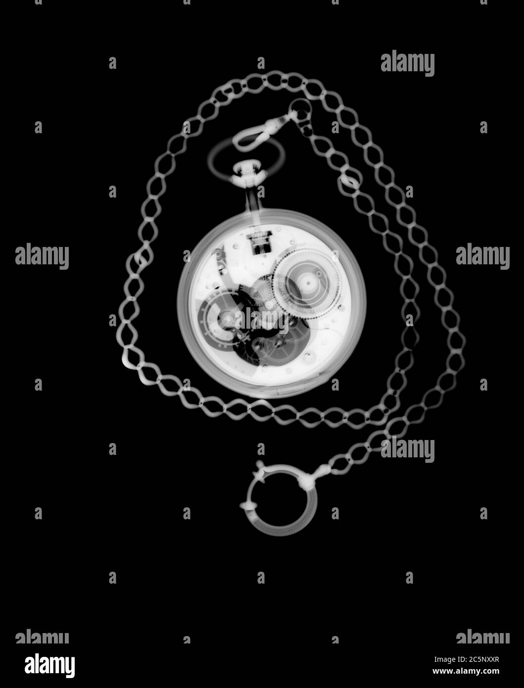 Reloj de bolsillo y cadena, rayos X. Foto de stock