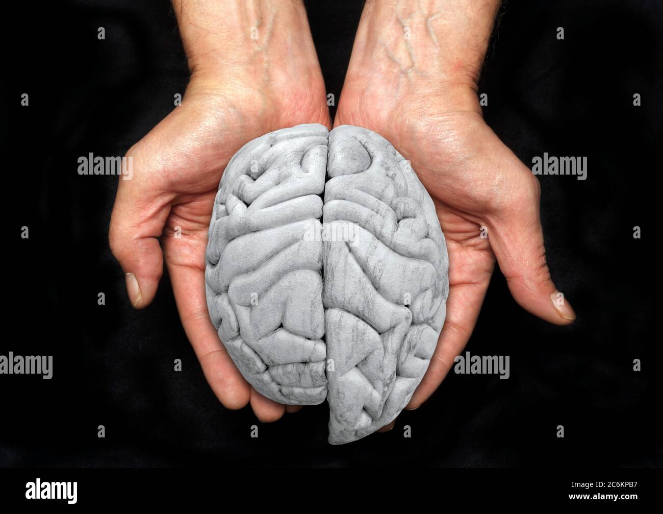 Hemisferio cerebral izquierdo ampliado, imagen conceptual. Esto podría representar la hemimegalencefalia (HME), una rara condición neurológica en la que un lado del cerebro es anormalmente más grande que el otro. También podría representar el uso de un lado del cerebro más que el. Foto de stock