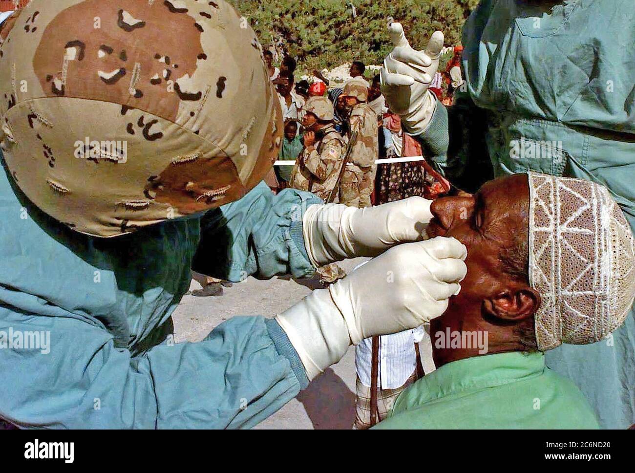 Un dentista de la US Navy (izquierda) examina los dientes de un hombre somalí como parte de un programa de acción cívica médica realizada en las calles de Mogadiscio, Somalia. El odontólogo es desde la Unidad Expedicionaria de la Marina, el Servicio de Apoyo Grupo 15, Camp Pendleton, California. Esta misión está en apoyo directo de la operación Restaurar la esperanza. Foto de stock