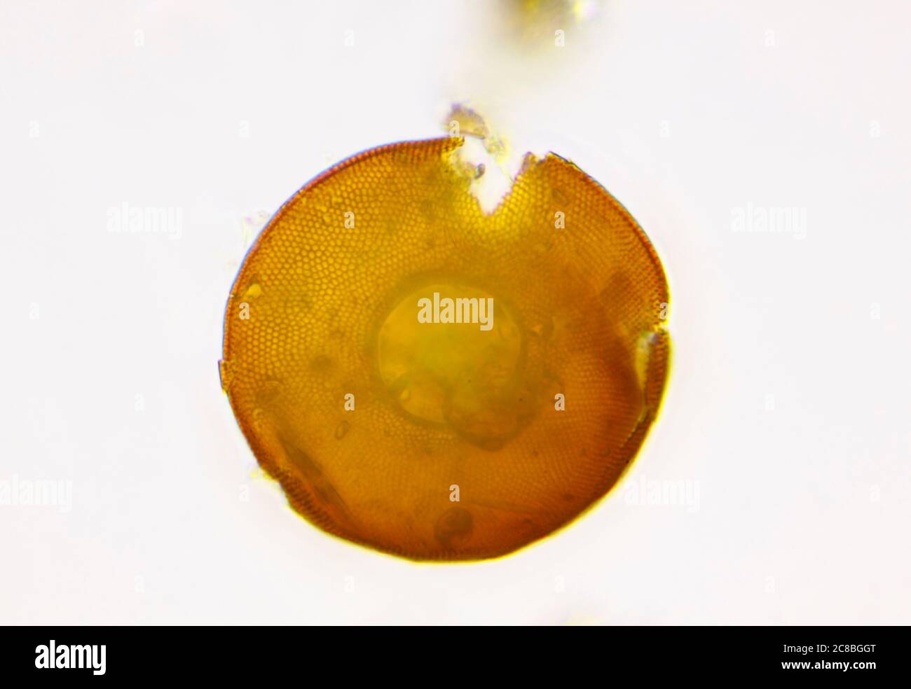 Vista microscópica de la concha de ameba (Arcella) de la finca con parte visible de la estructura interna. Iluminación de campo claro. Foto de stock