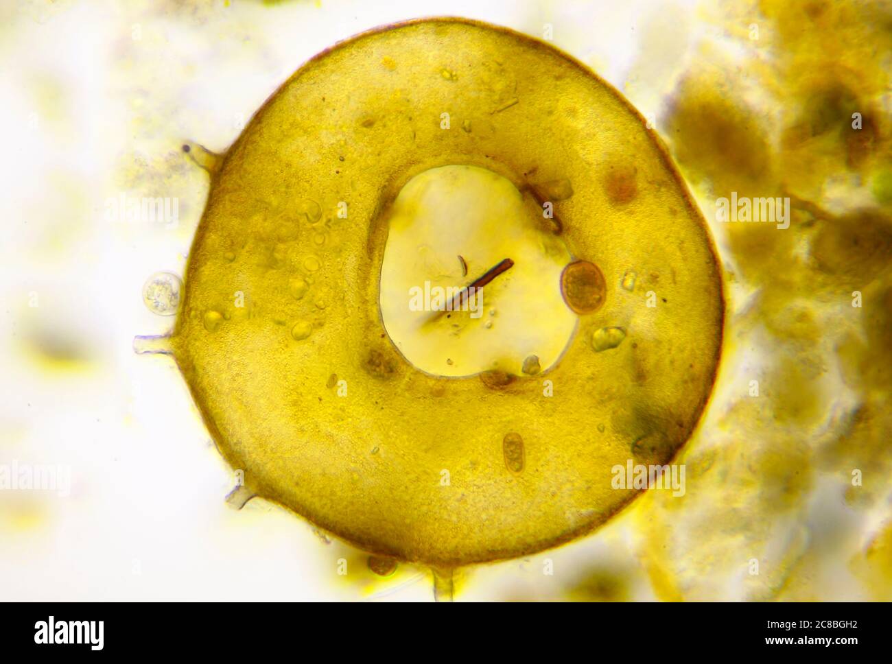 Vista microscópica de la concha de la ameba del estado (Centropyxis aculeata). Iluminación de campo claro. Foto de stock