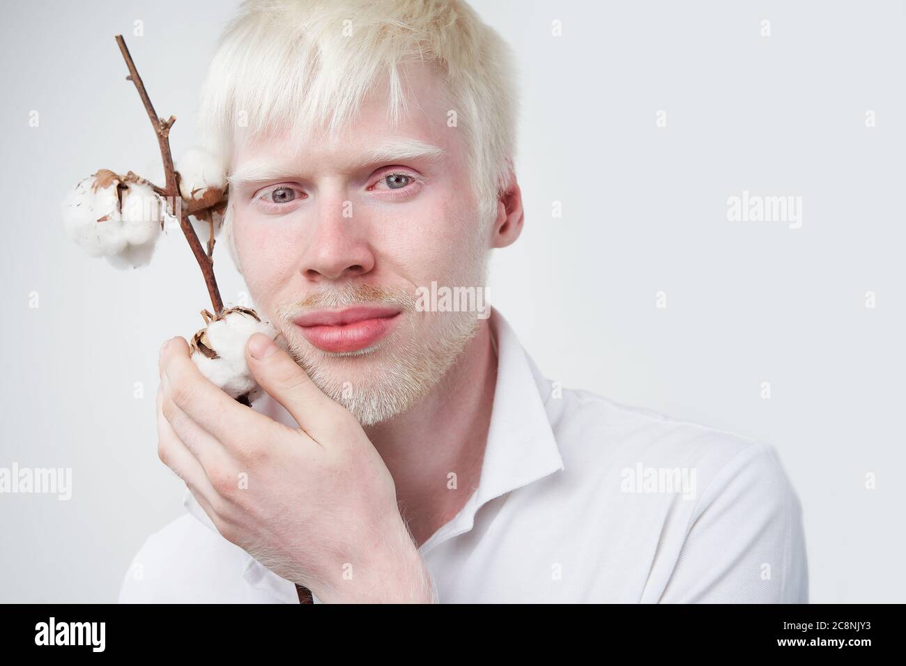 Albinismo sonrisa feliz albino hombre piel blanca cabello suave algodón suave suave brunch estudio vestido camiseta aisladas fondo blanco desviaciones anormales apariencia inusual anormalidad gente hermosa Foto de stock