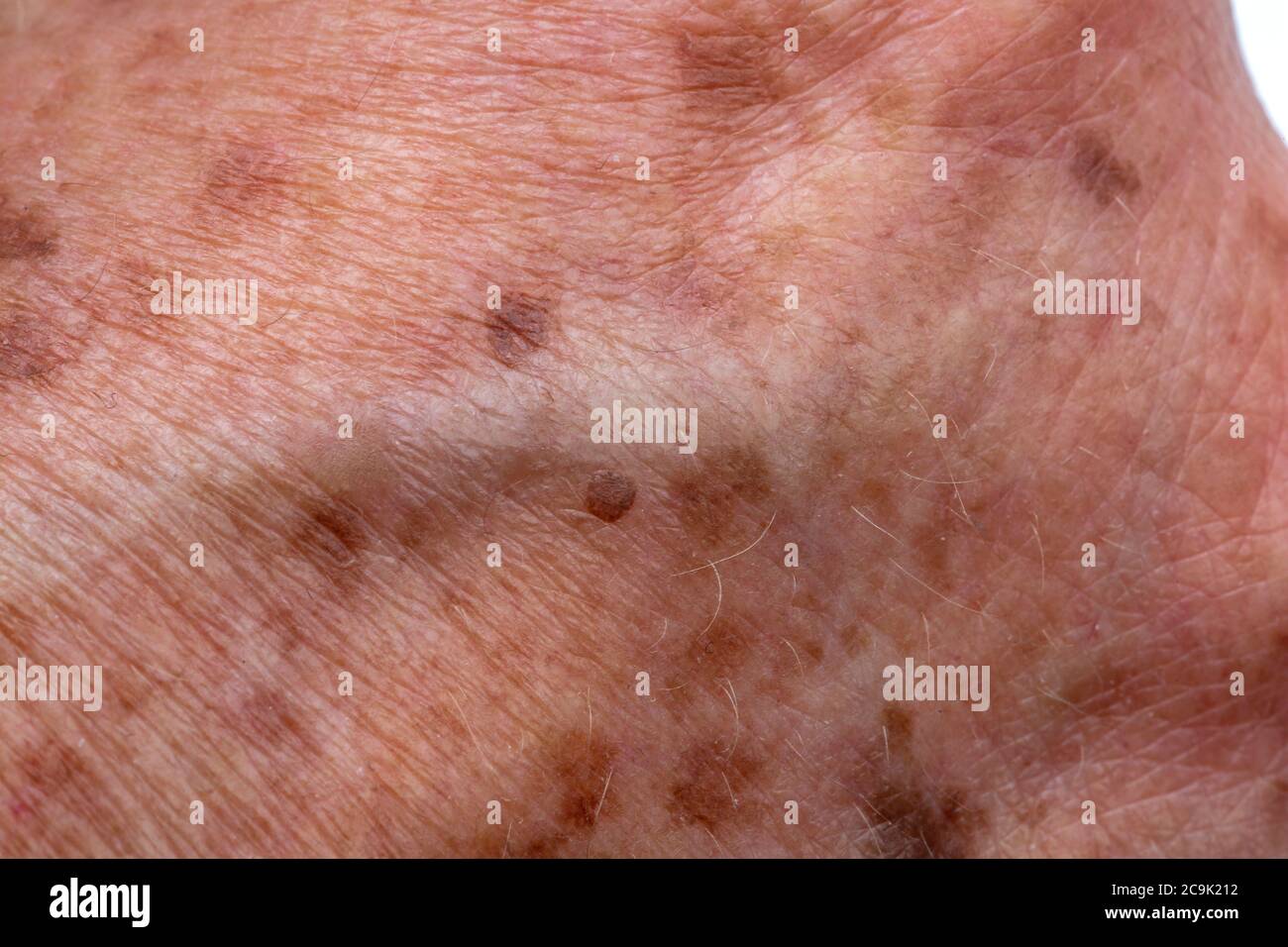 La edad, o el hígado, manchas en la mano de una mujer anciana Fotografía de  stock - Alamy