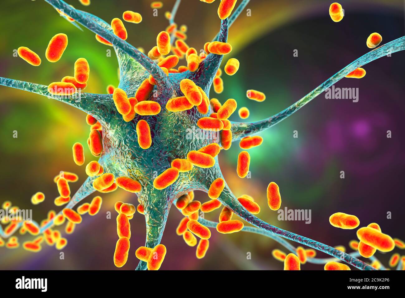 Encefalitis bacteriana. Ilustración conceptual de la computadora que muestra las bacterias que infectan las células cerebrales. Foto de stock