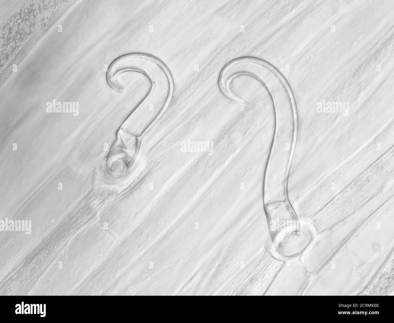 Hoja de frijol de jardín blanqueado (Phaseolus vulgaris) con tricomas bajo el microscopio, el limado horizontal de la vista es de aproximadamente 0,24mm Foto de stock