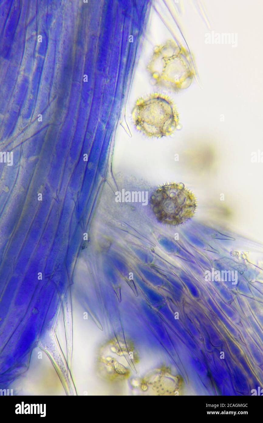 Vista microscópica de un detalle común de estigma de la flor de la achicoria (Cichorium intybus) y granos de polen. Iluminación de campo claro. Foto de stock