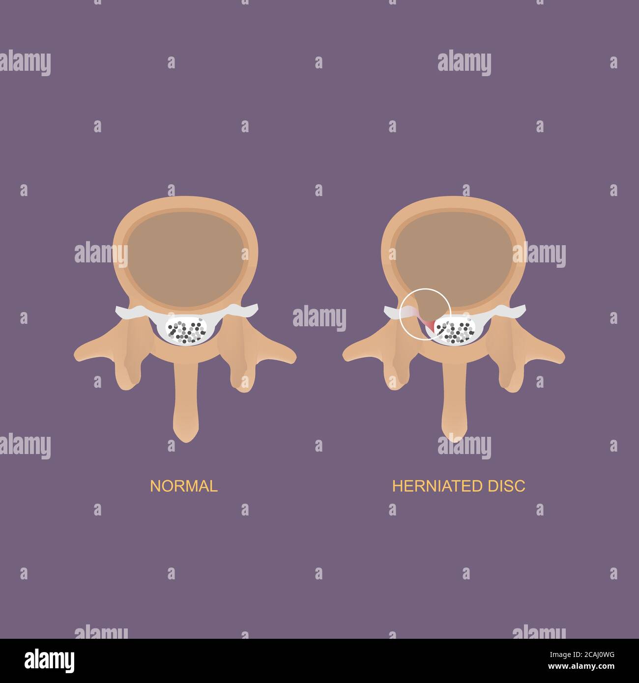 Demostración de la ilustración vectorial de la vista axial del disco