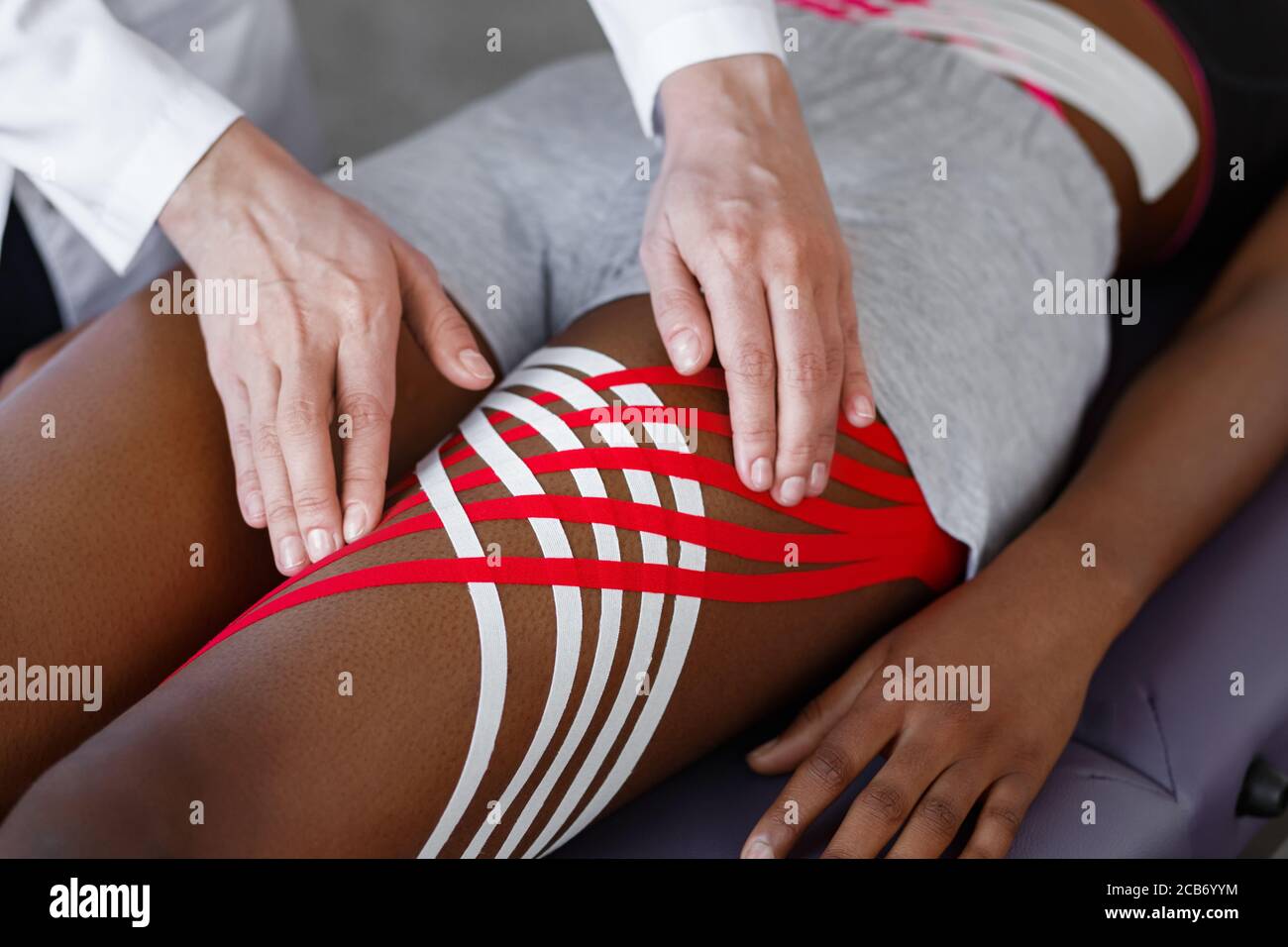 Grabación de Kinesiología. Fisioterapeuta aplicando cinta de cinesiología a las caderas del paciente.terapeuta tratando a una joven atleta afroamericana. Post traumático Foto de stock