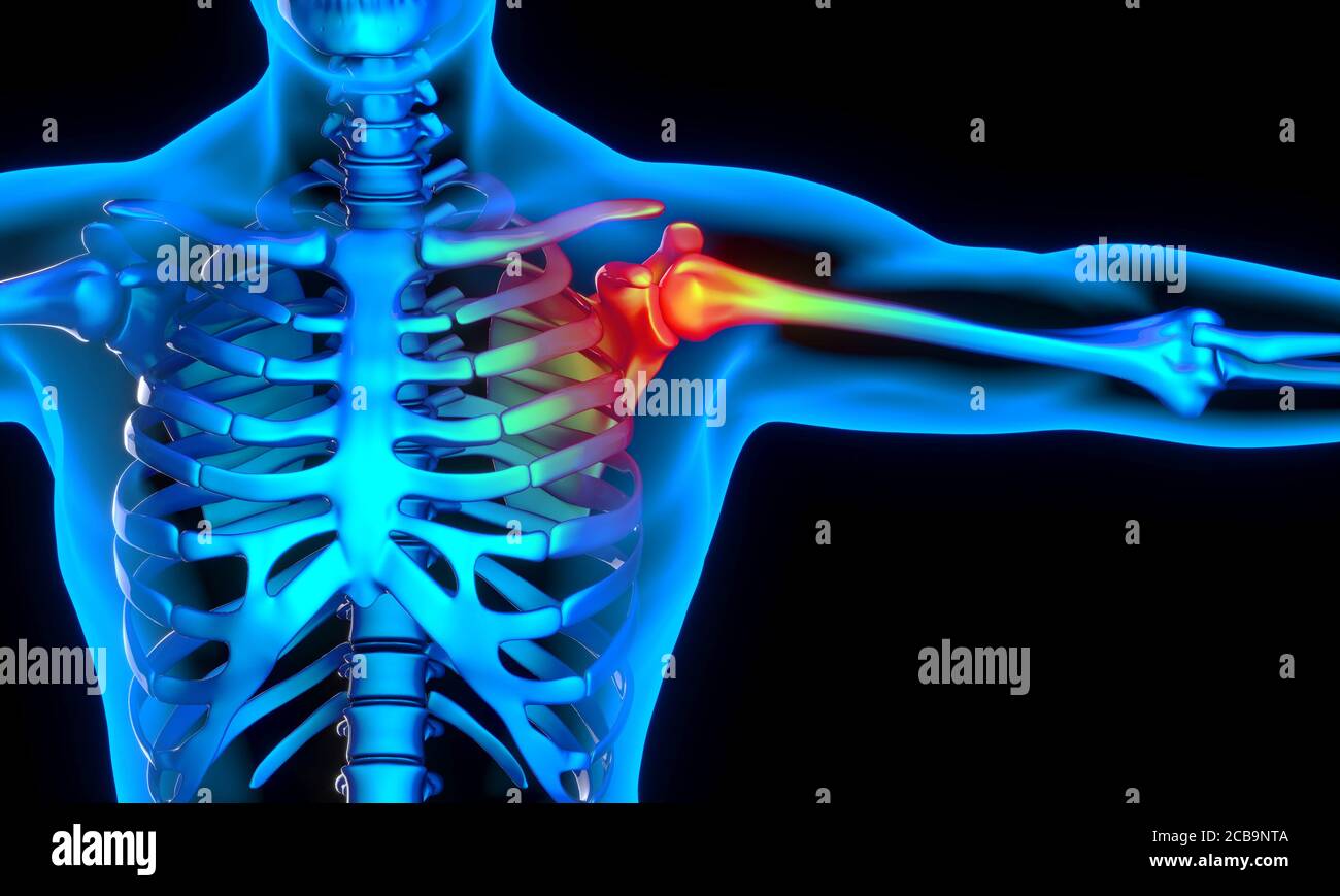 Problema del hombro y concepto del dolor. Medicina y salud. renderizar en 3d. Foto de stock