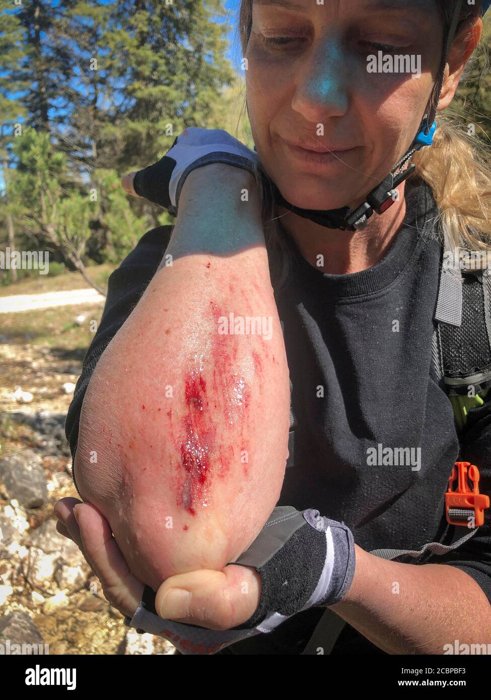 Mujer ciclista de montaña mirando su sangrado graze en su antebrazo después de una caída, Rofan montañas, Steinberg am Rofan, Tirol, Austria Foto de stock