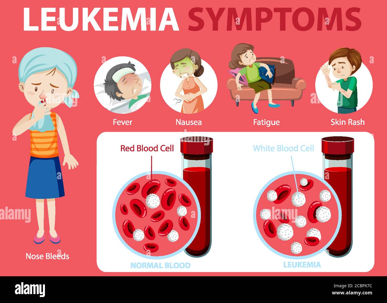 Síntomas De Leucemia Dibujos Animados Estilo Ilustración Infográfica Imagen Vector De Stock Alamy 7294