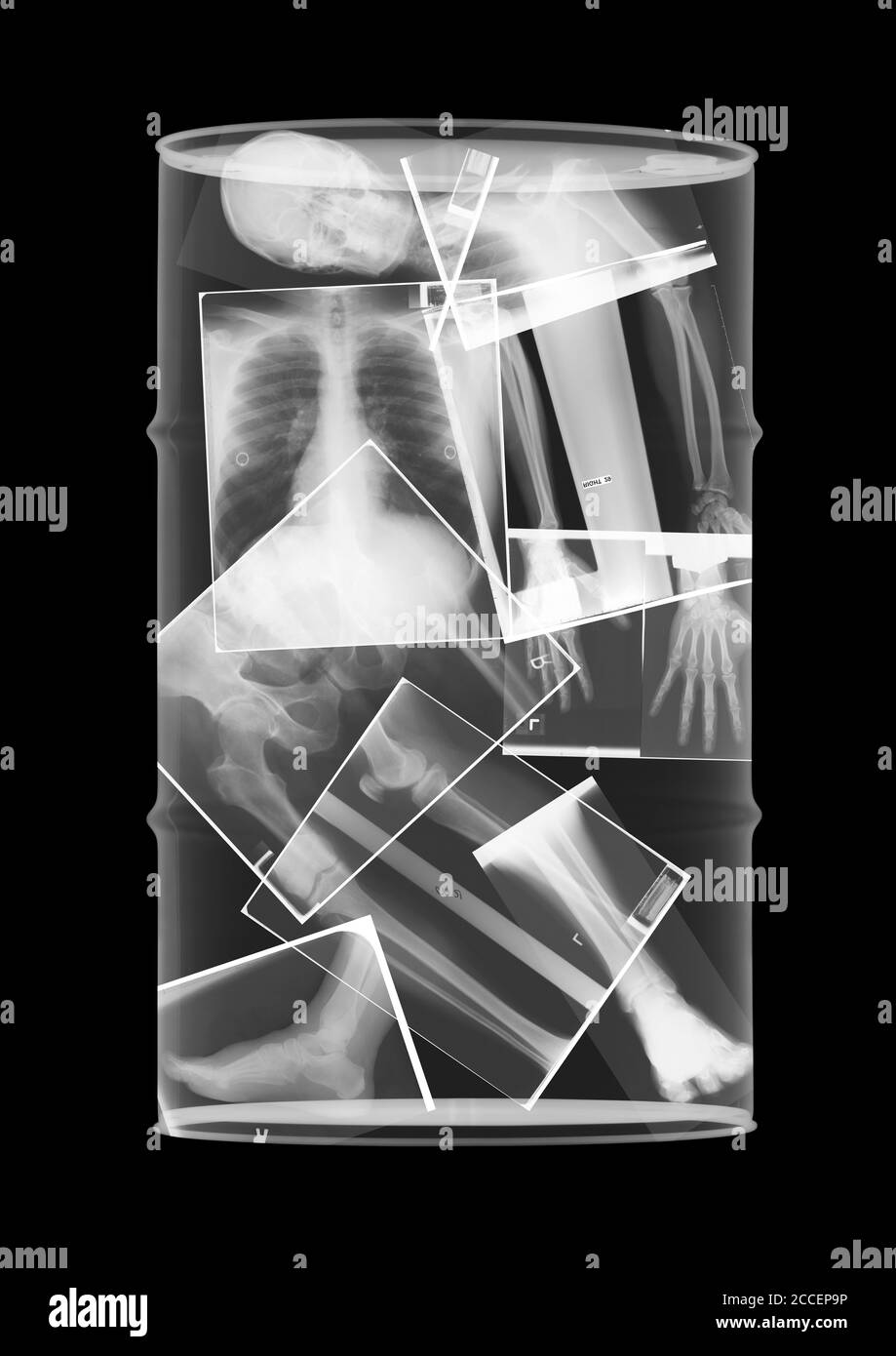 Esqueleto de tambor de aceite, rayos X. Foto de stock