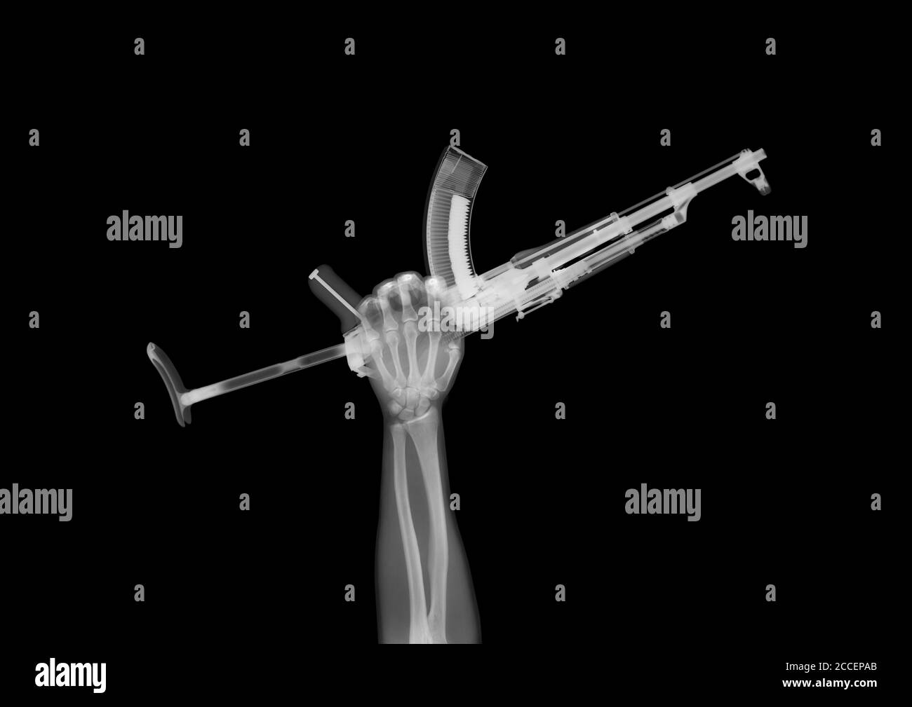 Brazo sosteniendo una ametralladora, rayos X. Foto de stock