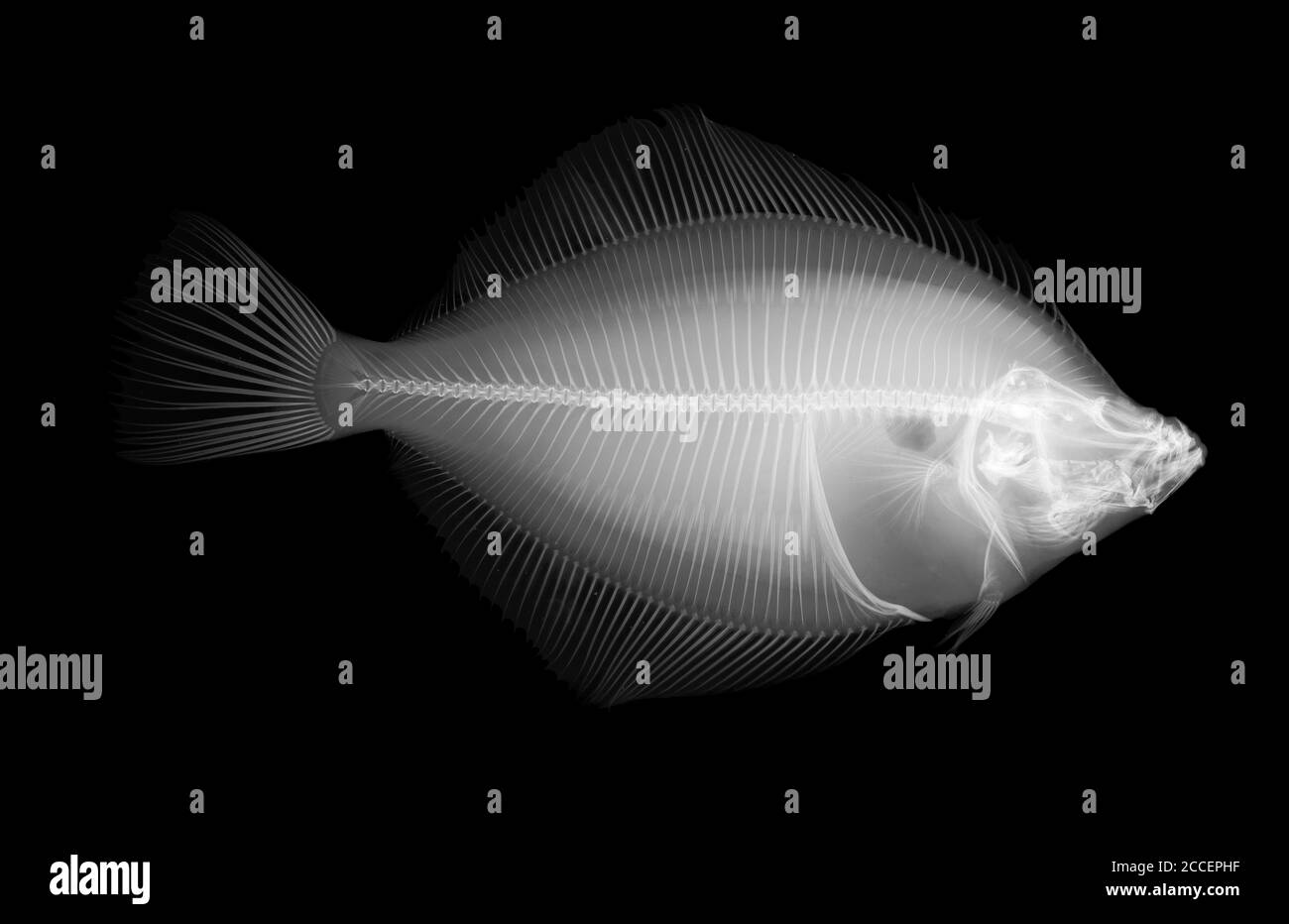 Platija de pescado, rayos X. Foto de stock