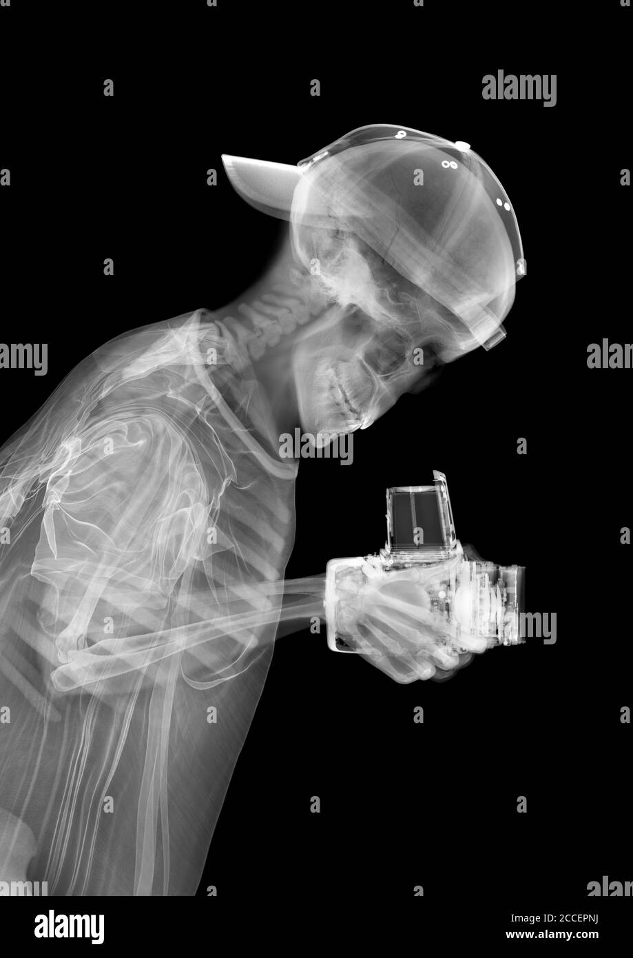 Esqueleto fotógrafo, rayos X. Foto de stock