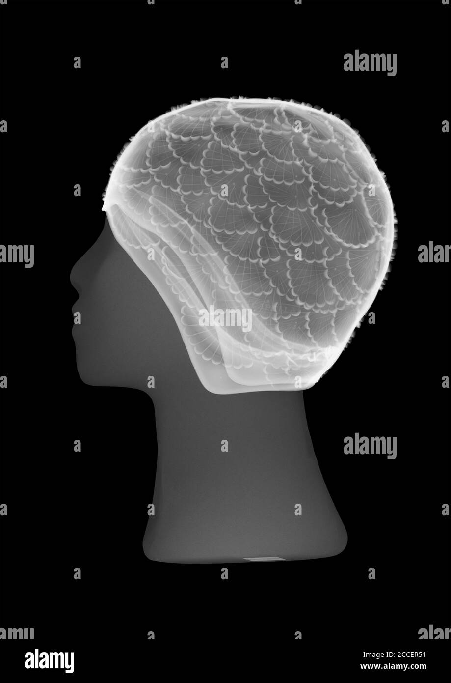 Gorro de ducha en una cabeza de maniquí, rayos X. Foto de stock
