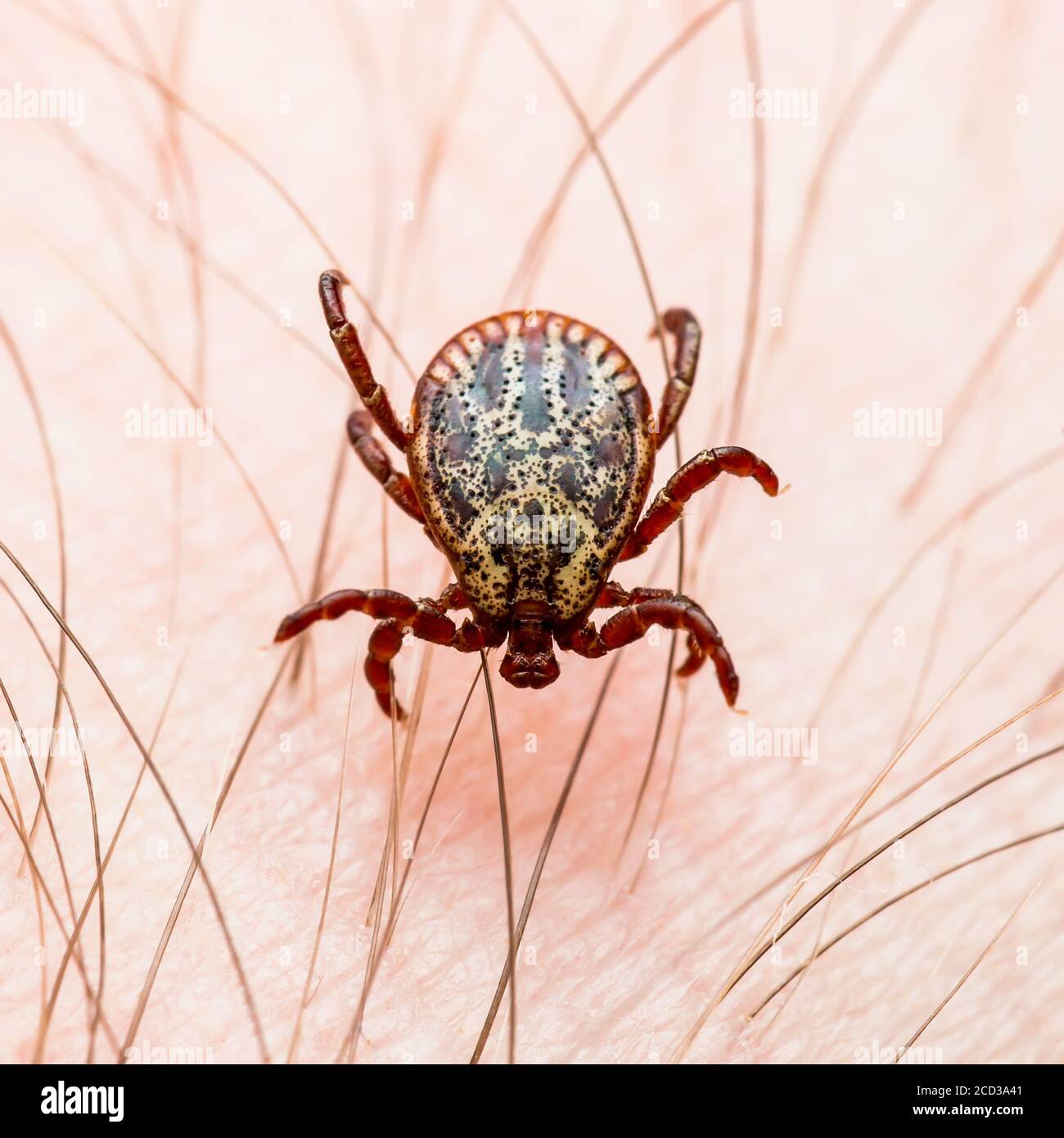 Encefalitis infecciosa garrapata insectos arrastrándose sobre la piel. Encefalitis virus o enfermedad de Lyme Borreliosis Dermacentor infectado parásito de garrapata Arachnid Macro Foto de stock