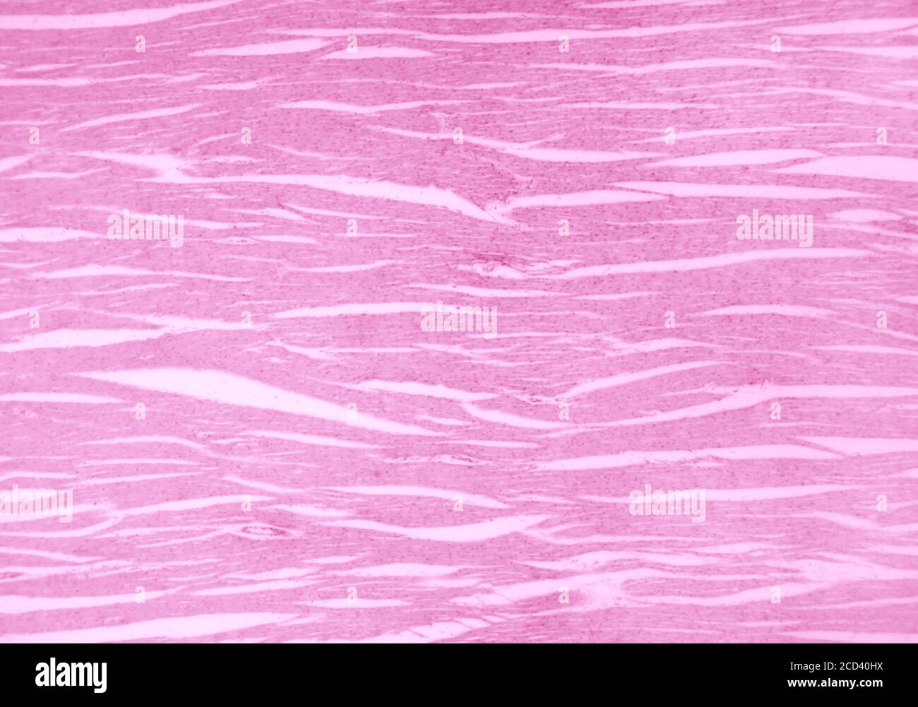 Sección del músculo cardíaco bajo un microscopio ligero. Músculo cardíaco, también miocardio, un músculo vertebrado. Músculo estriado. Foto de stock