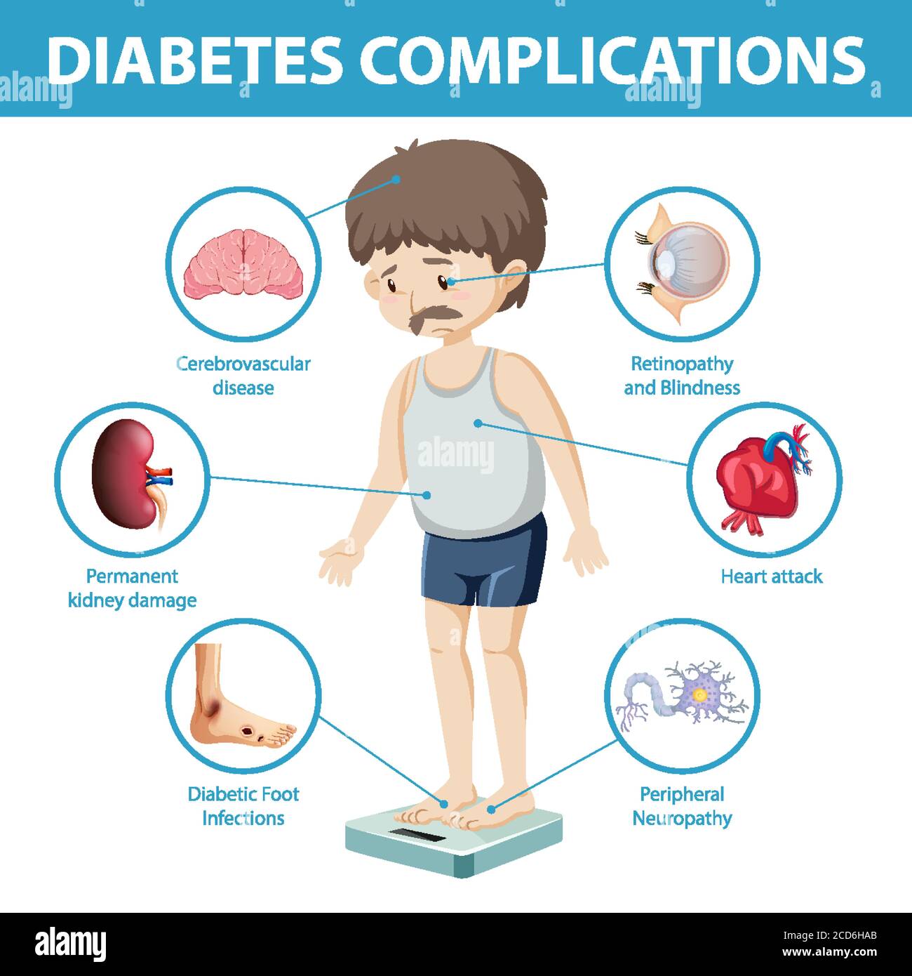 Información sobre complicaciones de la diabetes ilustración infográfica  Imagen Vector de stock - Alamy