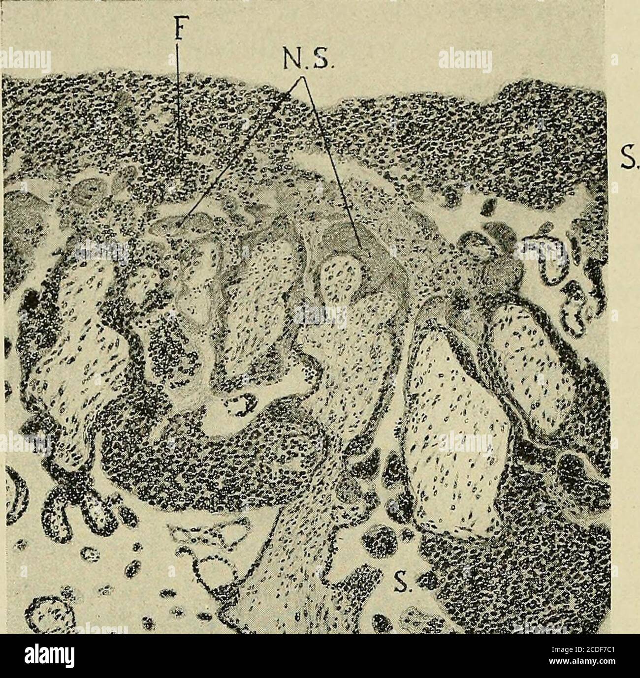 . Estudio de las causas subyacentes al origen de los monstruos humanos : tercera contribución al estudio de la patología de los embriones humanos . Fig. 80a.—Fotografía del óvulo y el embrión. Agrandado dos veces. La masa adicional de Thesmall forma un divertículo del óvulo, cuya cavidadof se comunica con el exqccelom a través de un estrecho abierto. La cola del embrión está torcida. 174 MALL. [Vol XIX. «»&gt;. •?w Foto de stock