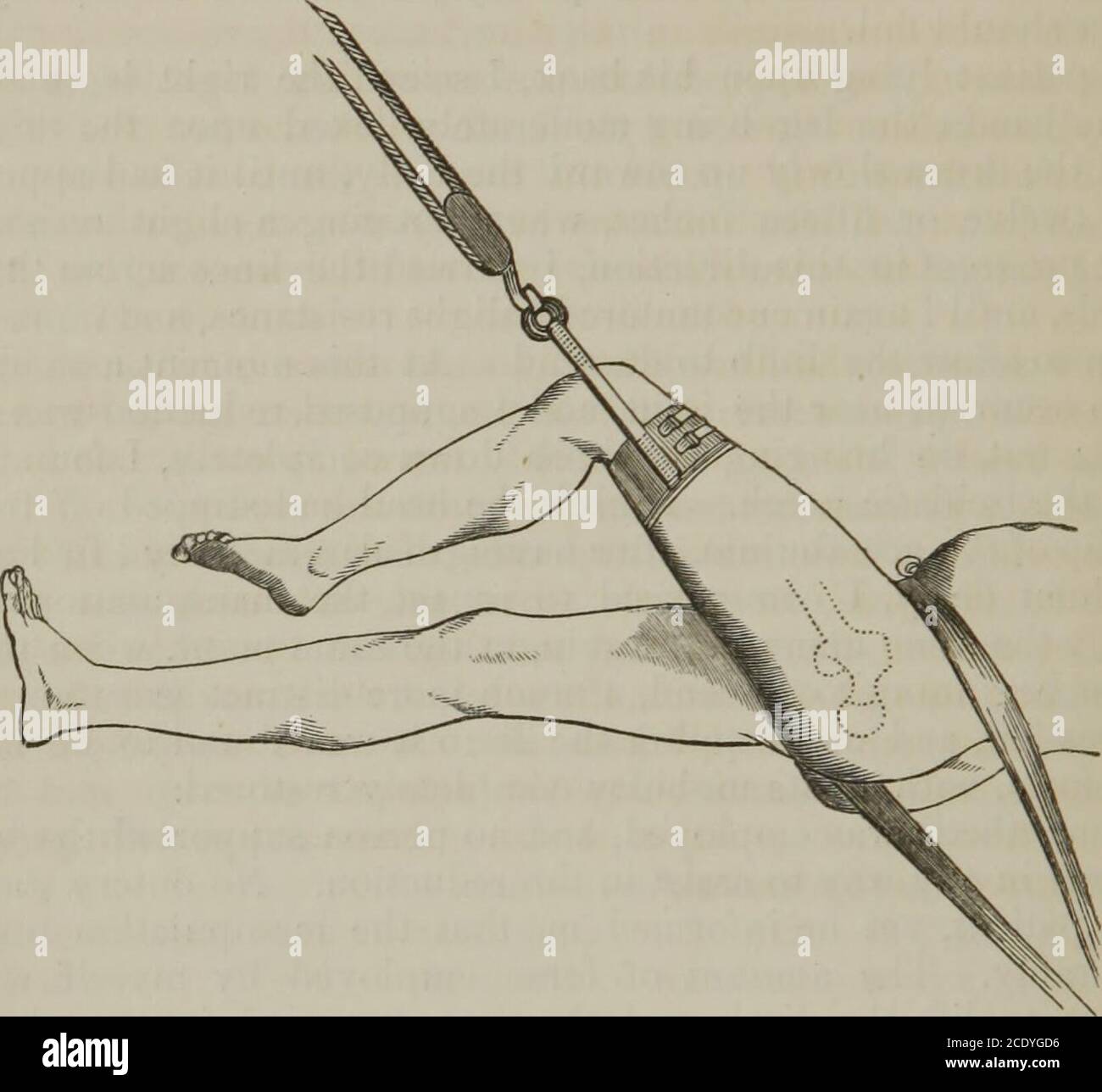 spirit bolsagage info