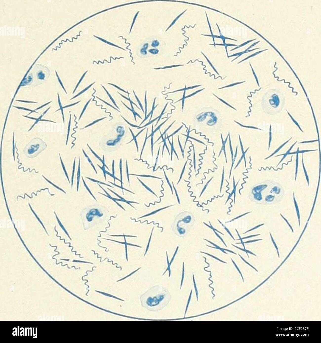 Enfermedades De La Boca Para Medicos Dentistas Estudiantes De Medicina Y Odontologia Placa Xlv Figura A Treponema Pallidum Celulas Pus Eritrocitos Y Cocci Figura 71 Treponema Microdentium Spi Rochaeta Pentium Treponema Macro Dentium Forma