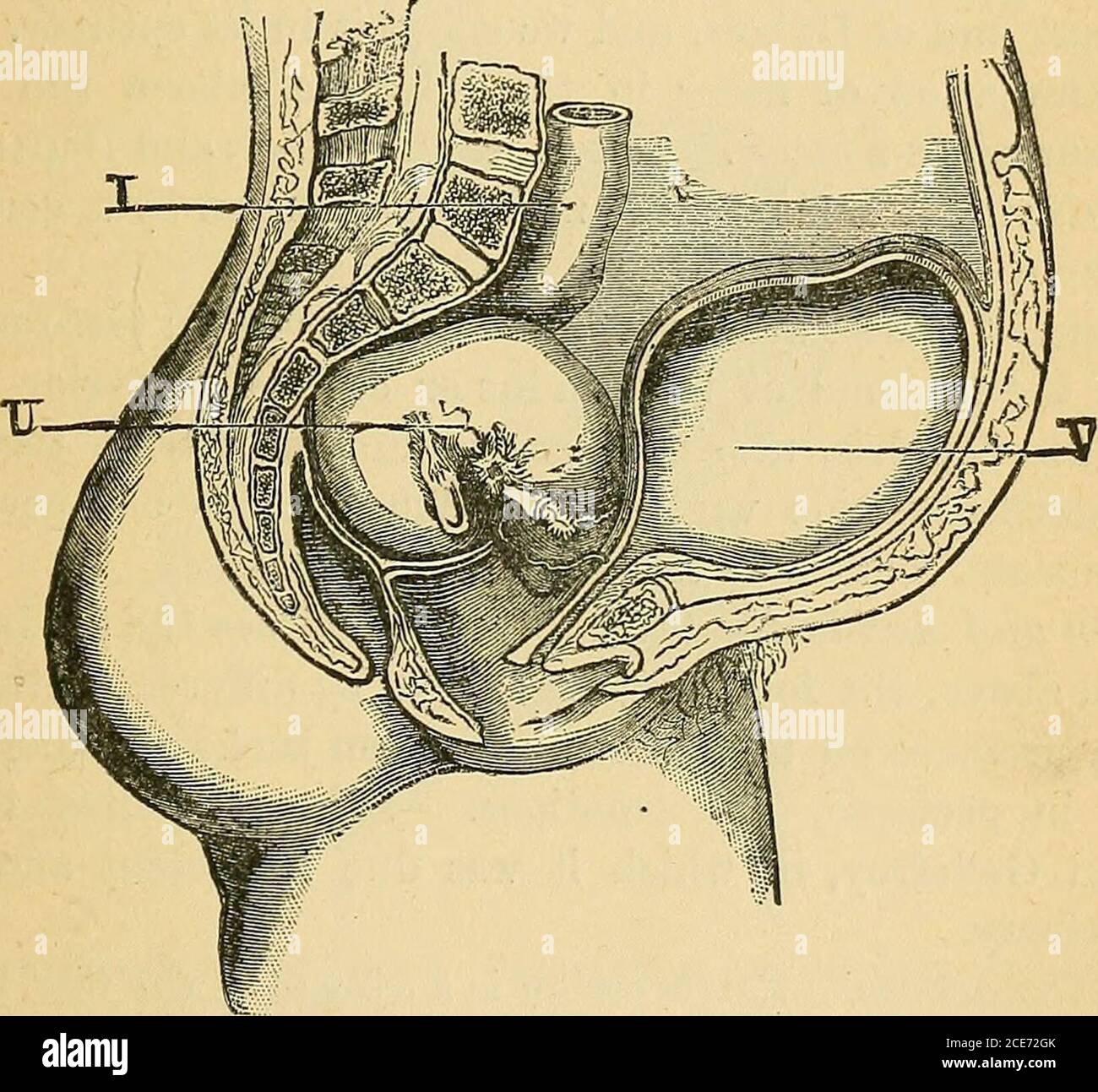 Tenesmo Fotos E Imagenes De Stock Alamy