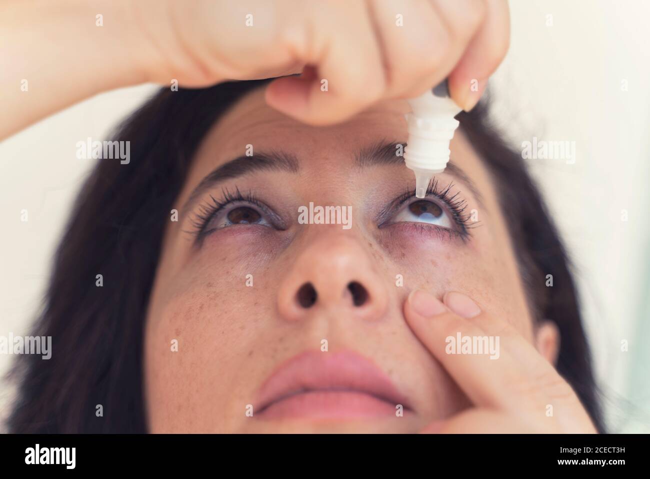 mujer que usa gota de ojo, mujer que deja caer el lubricante para los ojos  para tratar el ojo seco o la alergia; niña enferma que trata la irritación  o la inflamación