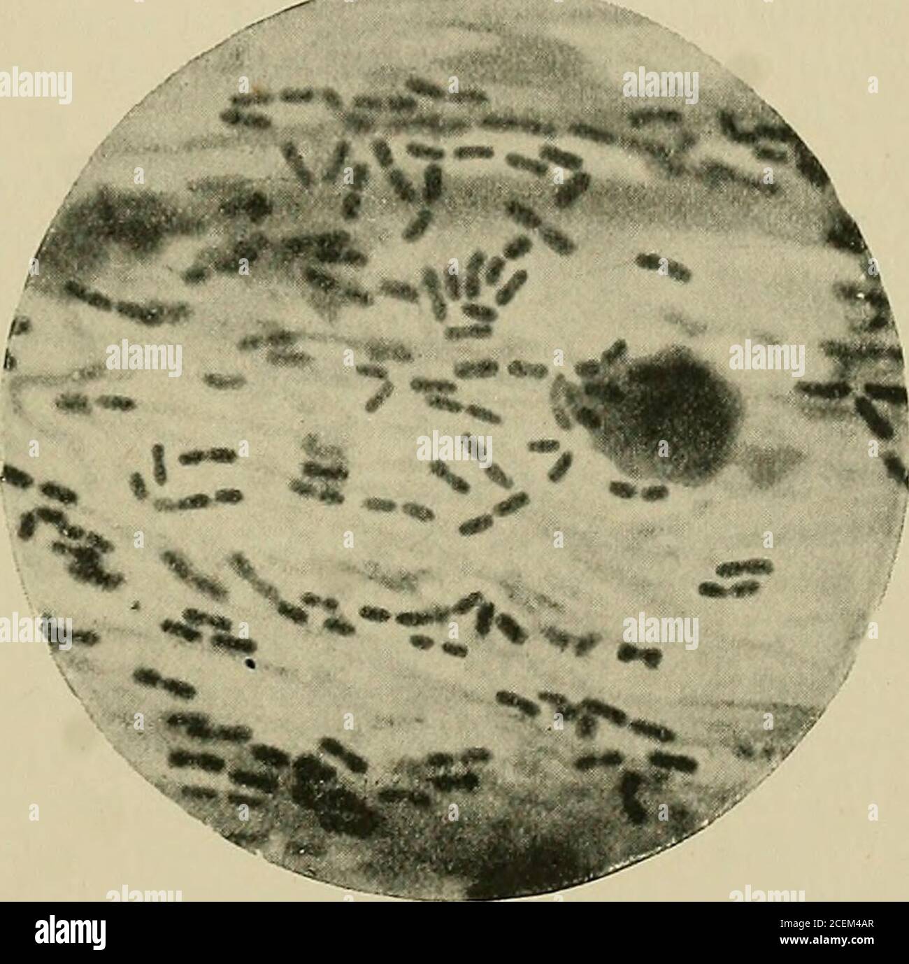 . La bacteriología del ojo. La tinciï¿½ de cï¿½ulas en micolarï¿½ por Bietti y Agricola mostrï¿½la presenciade un ectoplasma estrecho. Los suchmethods muestran cápsulas enmuchos bacilos, por ejemplo, ántrax de evenón. En una preparación secreta podemos decir que la mayoría de los Diplo-bacilli, sin mancha especial y con una amplia abertura, no muestran cápsula definida. Este es especialmente el caso con preparacionesteñidas por el método de gramos, y contratinadas con safranina, como se muestra en la placa I., Fig. III., exactamente extraído de la naturaleza. En lasesespectas los diplocococci difieren mucho de ~F riedl&nde8 Pneumob Foto de stock