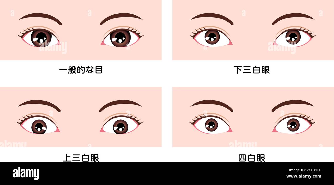 Varias Formas Oculares Tamano Y Posicion Diferentes Del Globo Ocular Ilustracion Vectorial Clasificaciones En Asia Imagen Vector De Stock Alamy