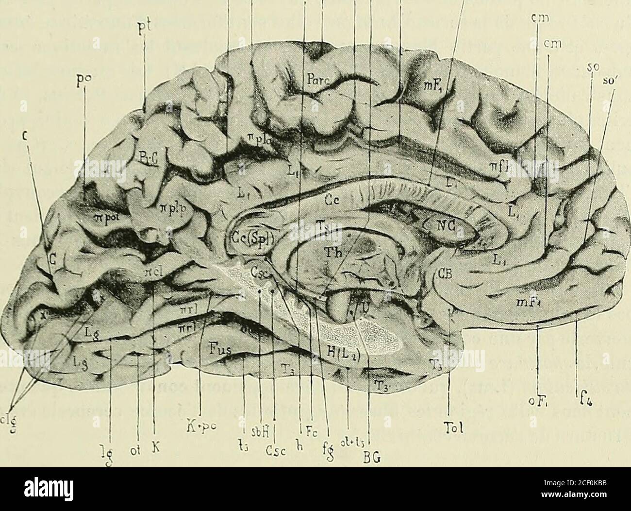 Anatomie des centers nerveux. Onstant, plus ou moins profondé-ment entaillé  par Vincisure temporale de Schwalbe (IT) ou sillon préitn-cique de  Brissaud. En dedans, la deuxième circonvolution limbique forme la lèvre  infé-rieure