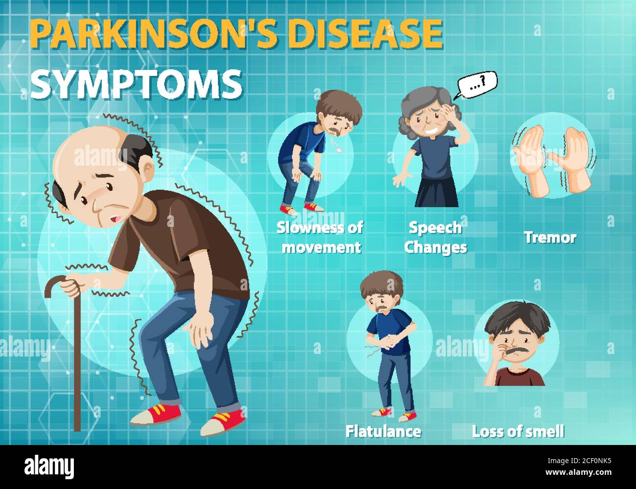 Ilustración infográfica de los síntomas de la enfermedad de Parkinson