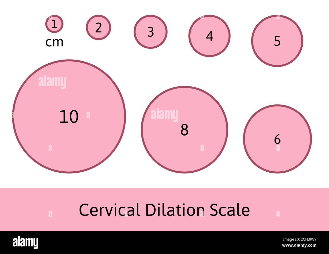 Escala de dilatación con círculos rosados. Muestra cómo se abre el cuello uterino durante el proceso de parto. Gráfico de ilustración médica en centímetros. Aislado Ilustración del Vector