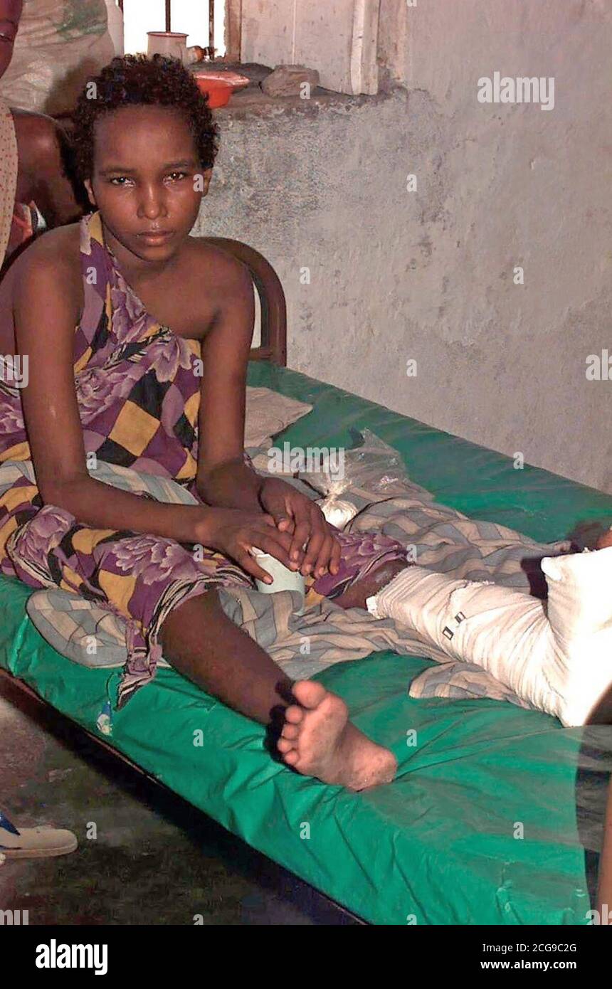 1993 - una joven muchacha somalí se sienta en una cama frente a la cámara. Ella tiene vendas y una férula de yeso en su pierna izquierda. Ella está recuperándose de una herida de bala que recibió cuando ella estaba en las cercanías de un raid en un convoy de abastecimiento de la ONU por bandidos fuera de Bardera, Somalia. Fue tratada y se está recuperando en el hospital de Bardera. Esta misión está en apoyo directo de la operación Restaurar la esperanza. Foto de stock