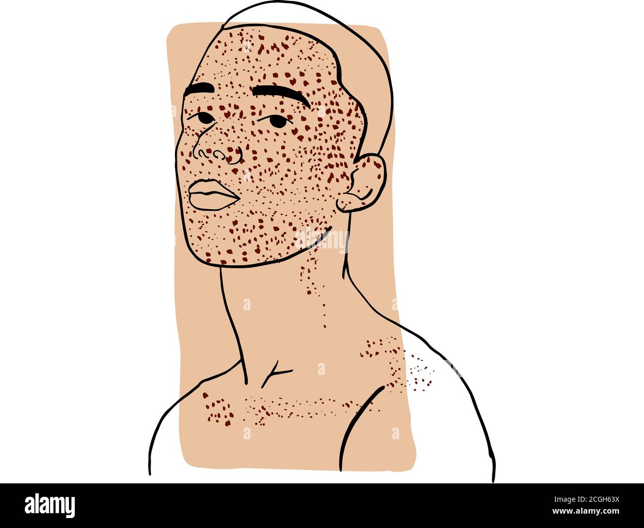 Dibujo a mano retrato de un joven con su cara cubierta por pecas y color beige oscuro muestra. Colección abstracta de diferentes personas y piel Foto de stock