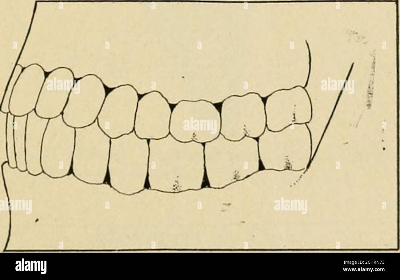 Técnicas de anatomía operatoria y dental; un manual de clase y laboratorio  para estudiantes de odontología de primer año. Fig. 29.—segundo molar  inferior derecho. Superficie oclusal. A,lóbulo mesio-lingual; B, lóbulo  disto-lin-gual;