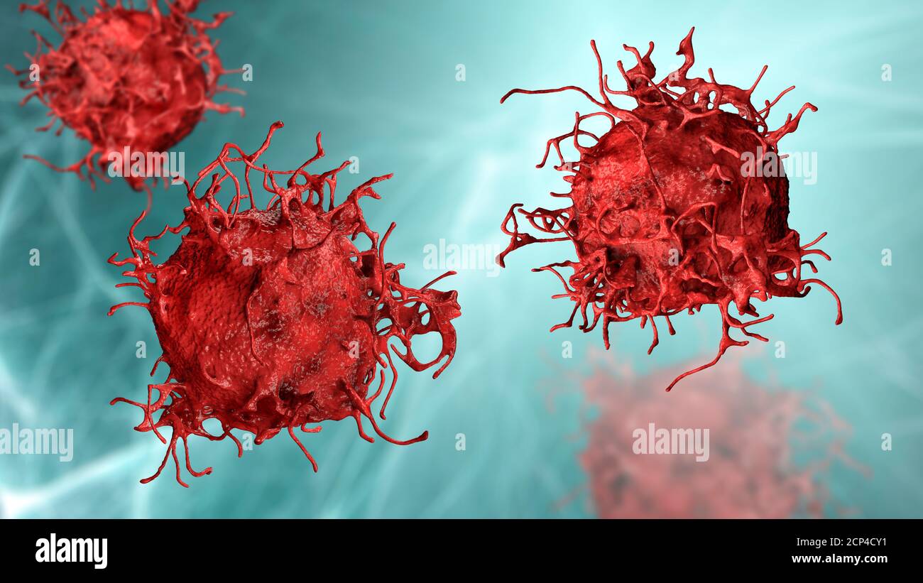 Célula de cáncer de piel, ilustración por computadora. Foto de stock