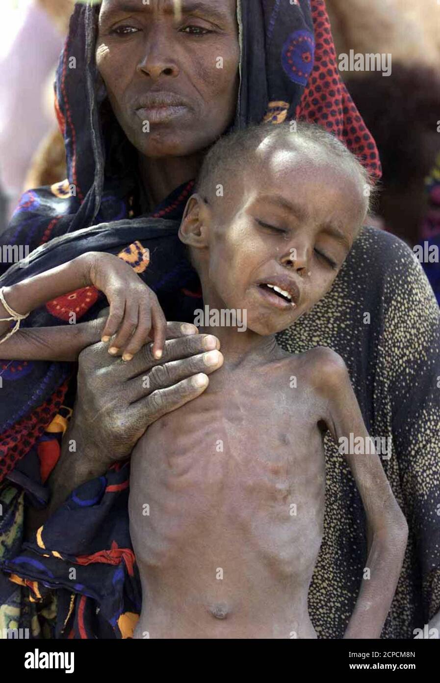 Imagenes Niños De Africa En Desnutricion Una mujer tiene a su hijo de desnutrición en la ciudad de Danan al suroeste  de Addis Abeba el 7 de abril. Ocho niños mueren cada día de hambre en la  remota