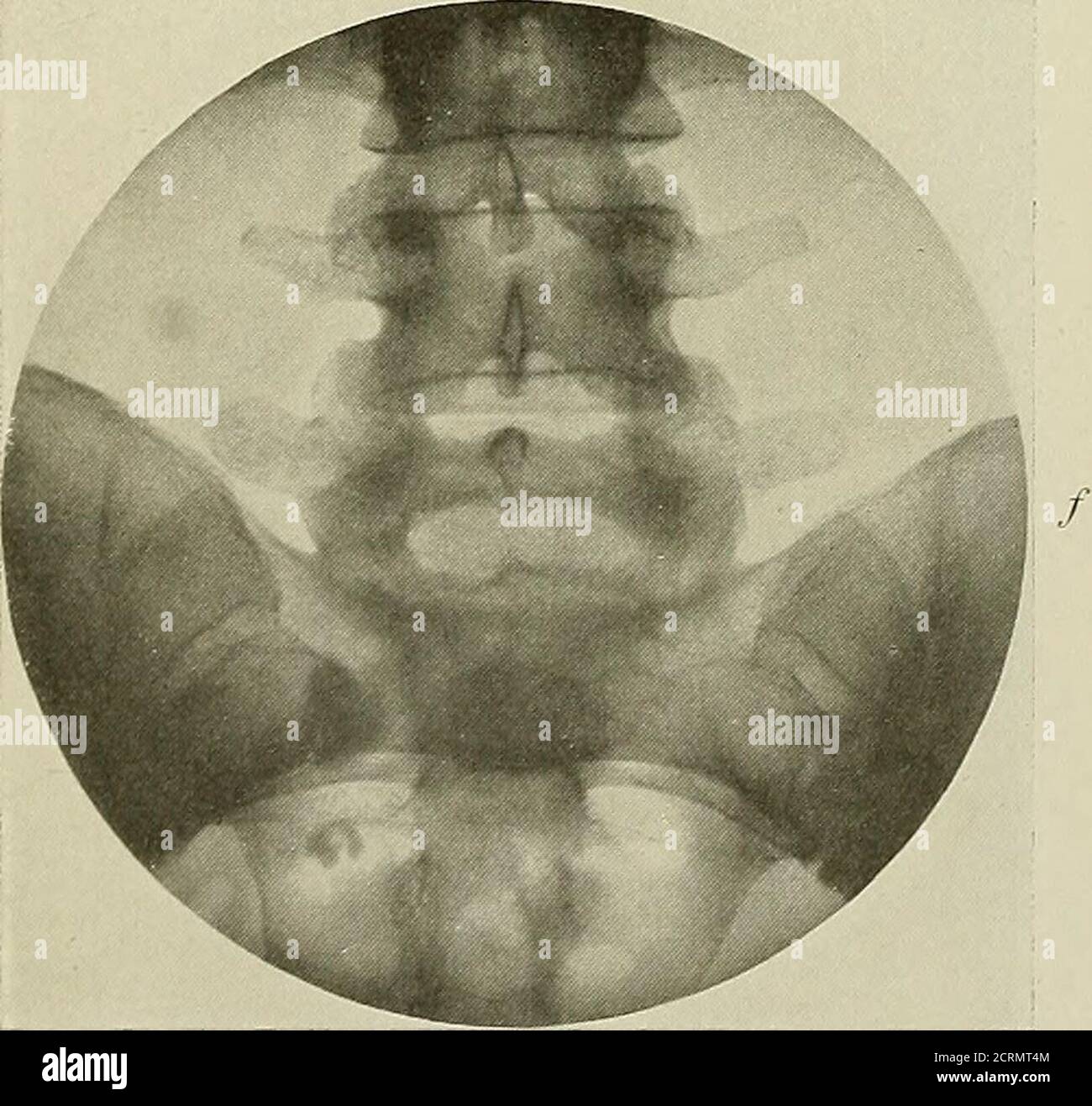 Dermoide Fotos E Imagenes De Stock Alamy