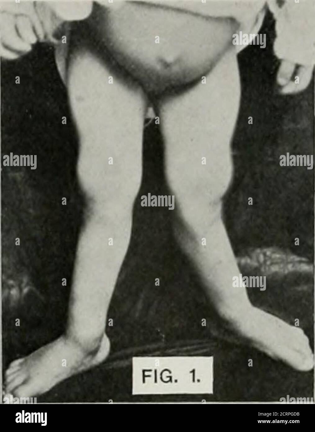 . Anatomía viva y patología; el diagnóstico de enfermedades en la vida temprana por el método de Roentgen . Foto de stock