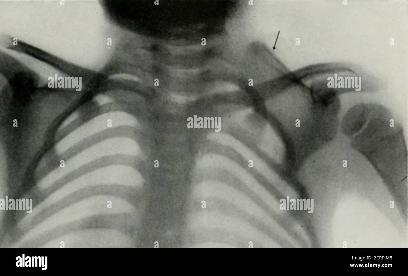 . Anatomía viva y patología; el diagnóstico de enfermedades en la vida temprana por el método de Roentgen . ;=4. Foto de stock