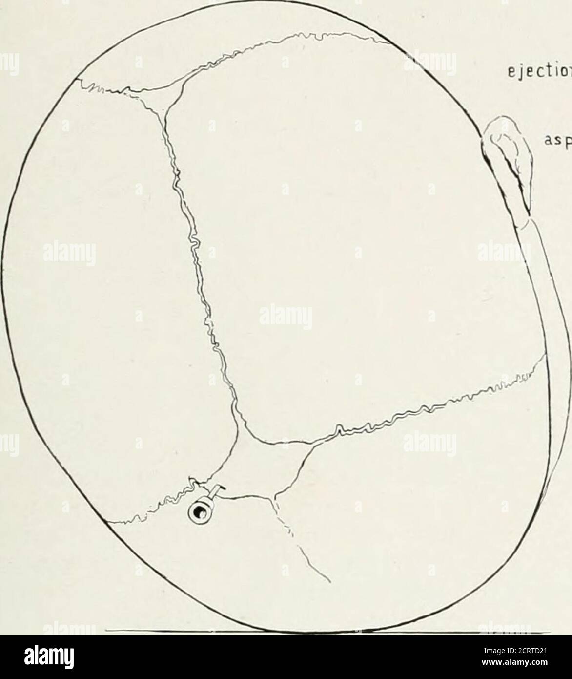 . La revista americana de roentgoenología, terapia de radio y medicina