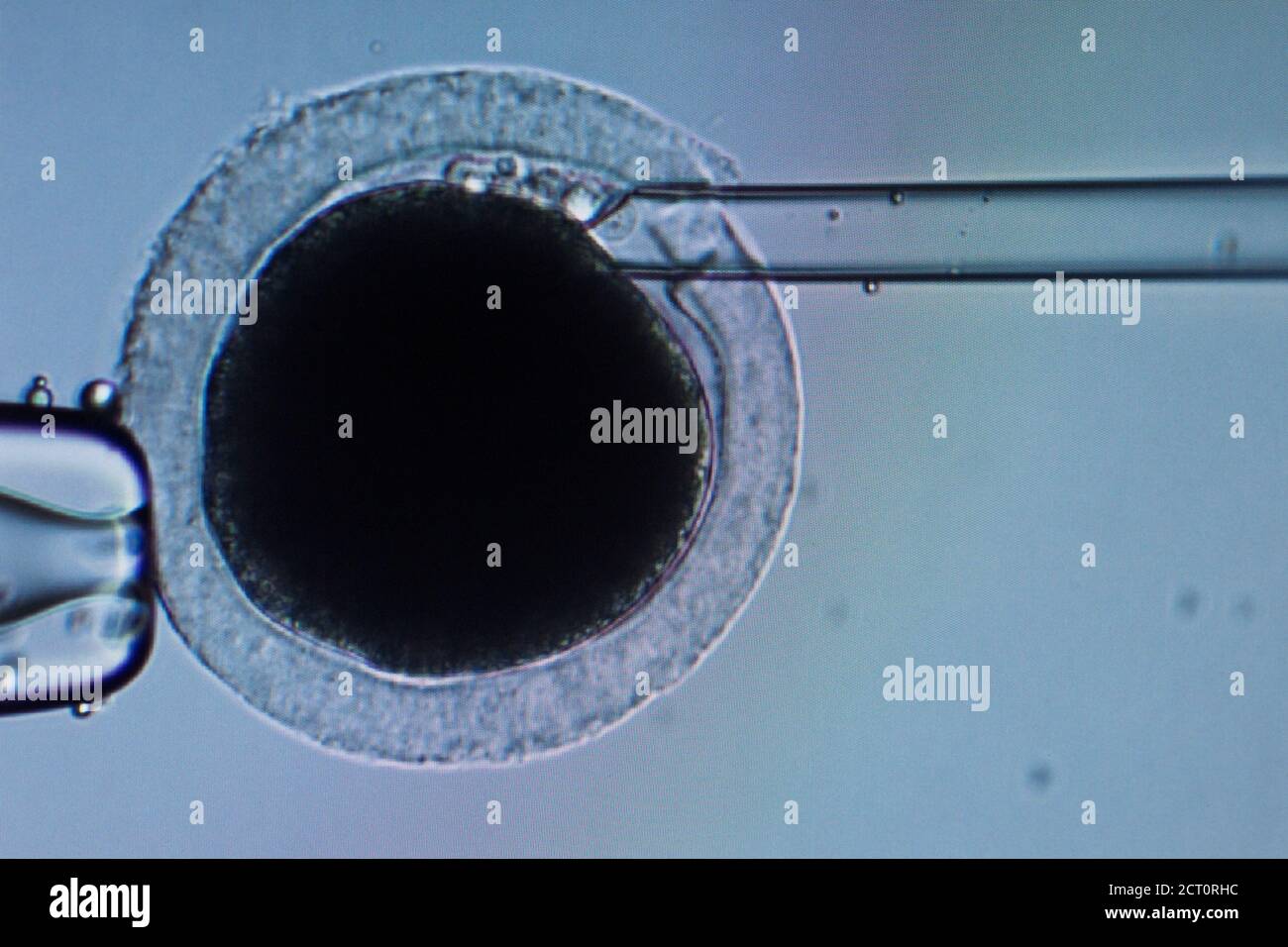 Una pantalla muestra la imagen microscópica de un intento de inseminar un huevo de perro en un laboratorio de la compañía biotecnológica Sinogene que se especializa en la clonación de perros en Beijing, China 15 de junio de 2018. Foto tomada el 15 de junio de 2018. REUTERS/Thomas Peter Foto de stock
