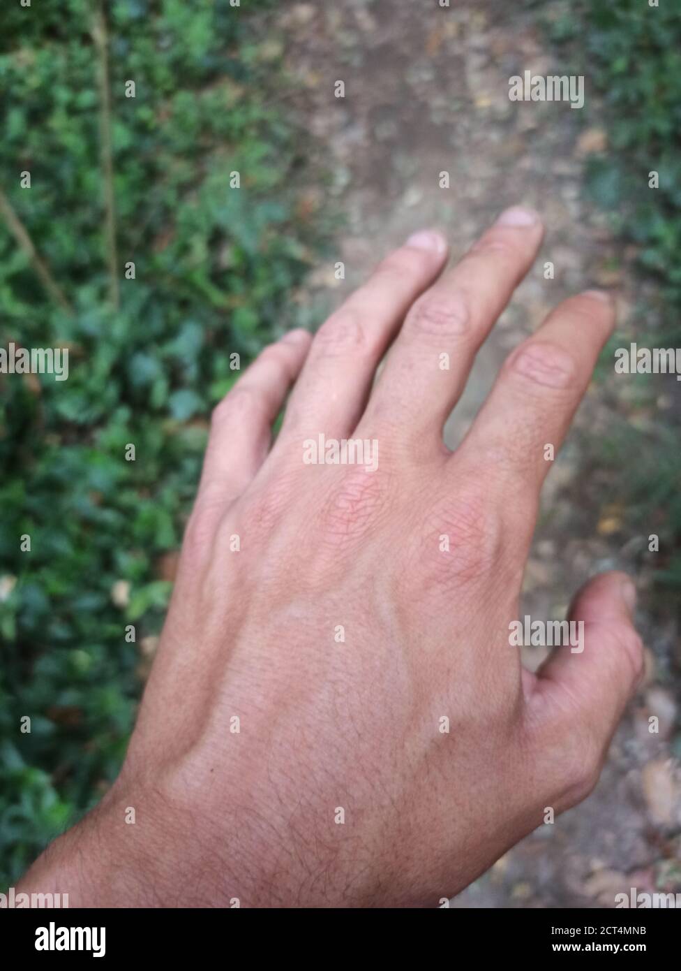 Tiro vertical de la mano de un hombre con venas abultadas un fondo borroso Foto de stock