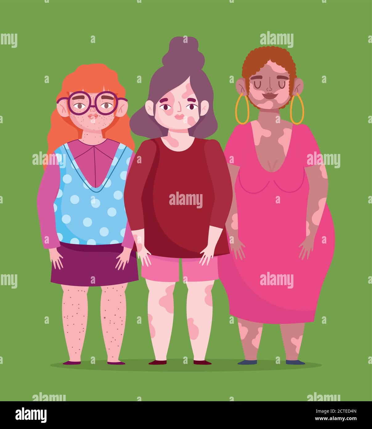 perfectamente imperfecto, grupo de dibujos animados femeninos con vitiligo, pecas, problema de la piel vector ilustración Imagen Vector de stock - Alamy perfectamente imperfecto, grupo de dibujos animados femeninos con vitiligo, pecas, problema de la piel vector ilustración Imagen Vector de stock - Alamy