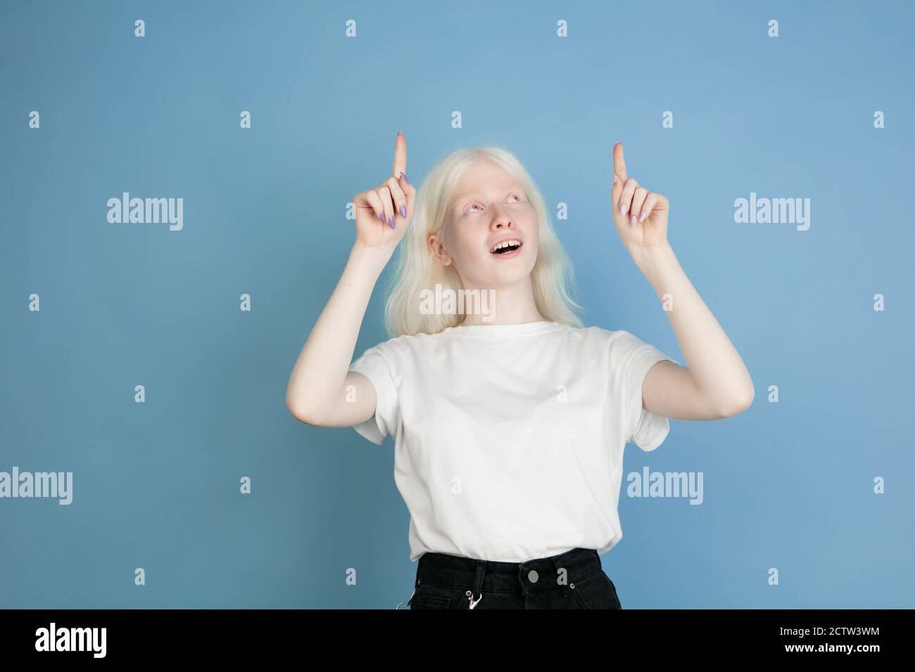 Niña albina fotografías e imágenes de alta resolución - Alamy
