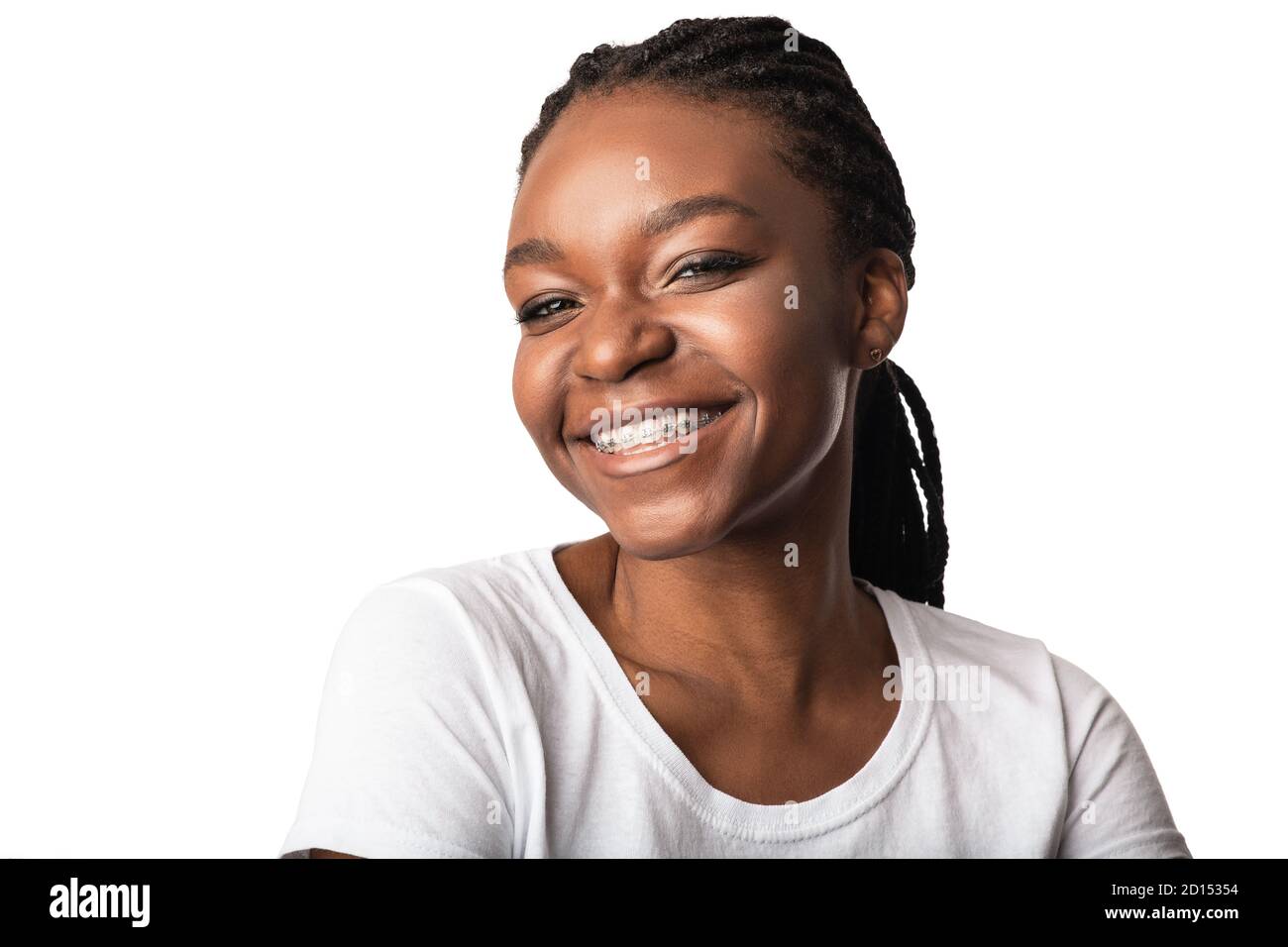 Mujer africana con braces dentales sondeando posando sobre fondo blanco Foto de stock