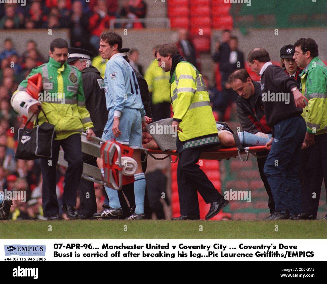 07-ABR-96. Manchester United contra Coventry City ... Dave Busst de Coventry es llevado después de romper su pierna Foto de stock